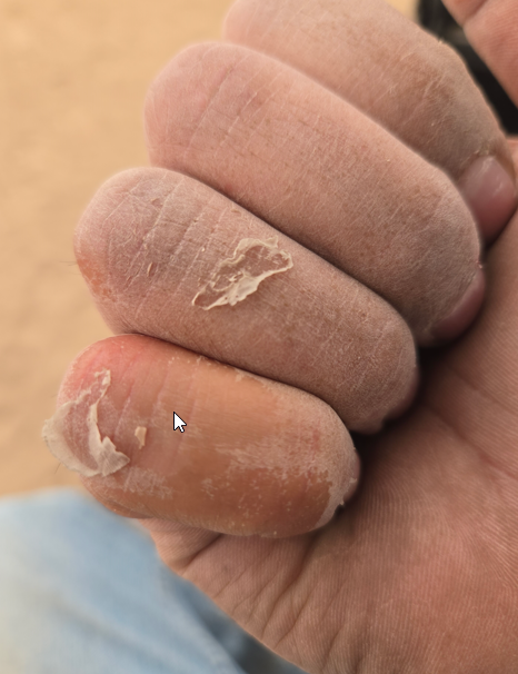 My hands after a long day